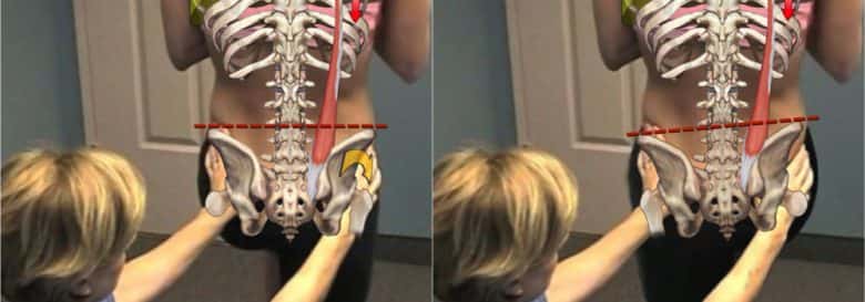 pelvic thoracic